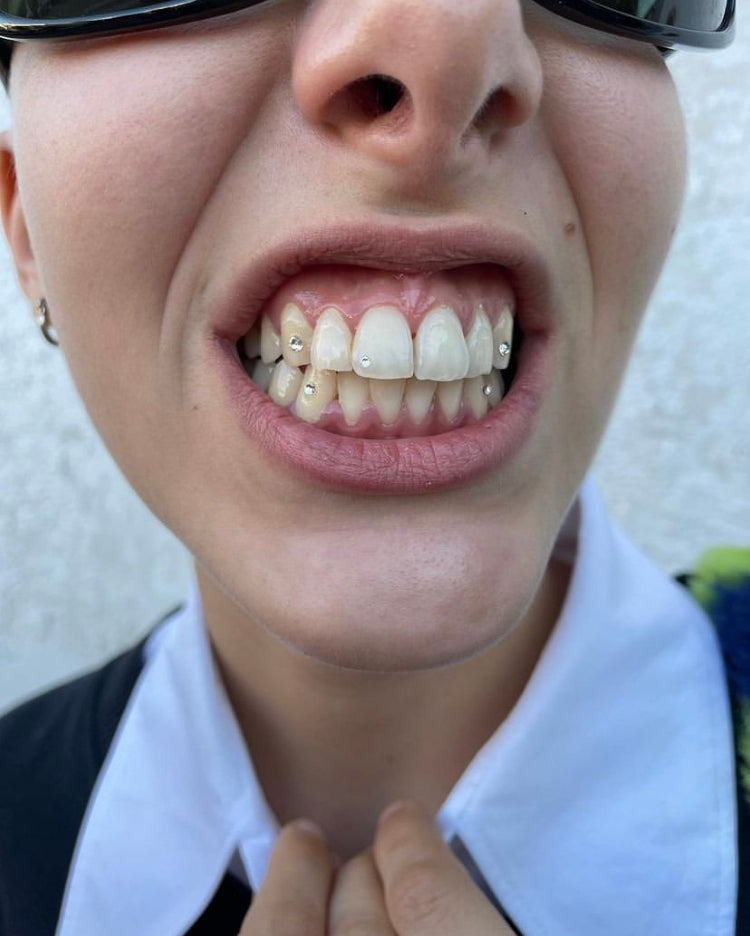 Kit de inicio de gemas dentales